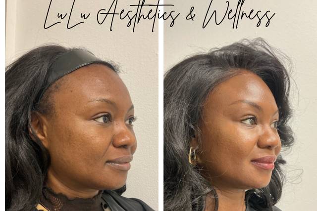 LuLu Aesthetics & Wellness