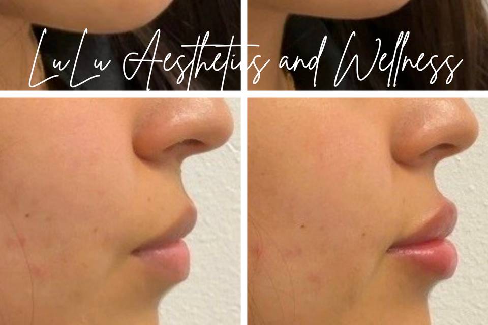 LuLu Aesthetics & Wellness