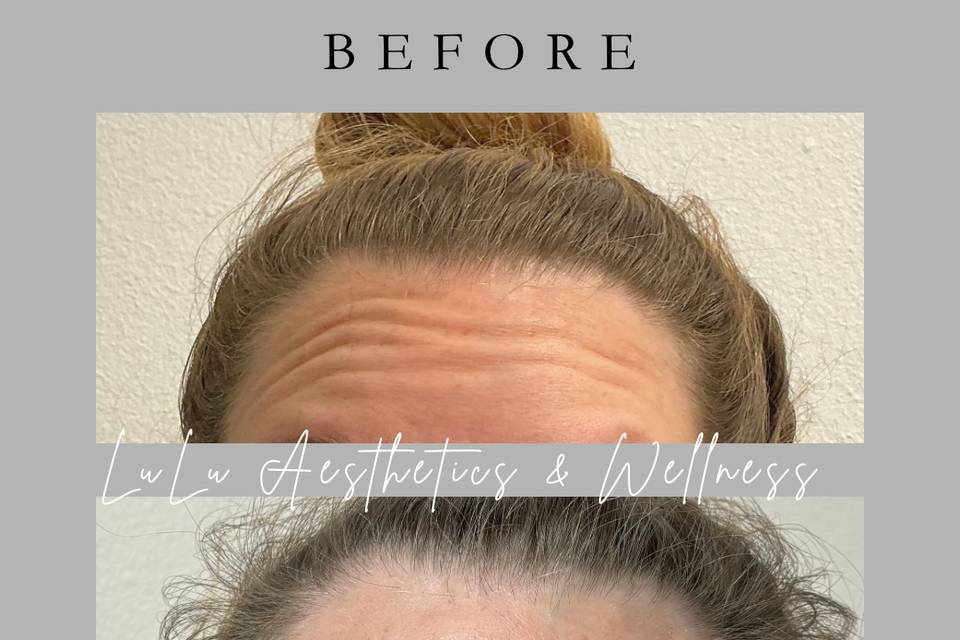LuLu Aesthetics & Wellness