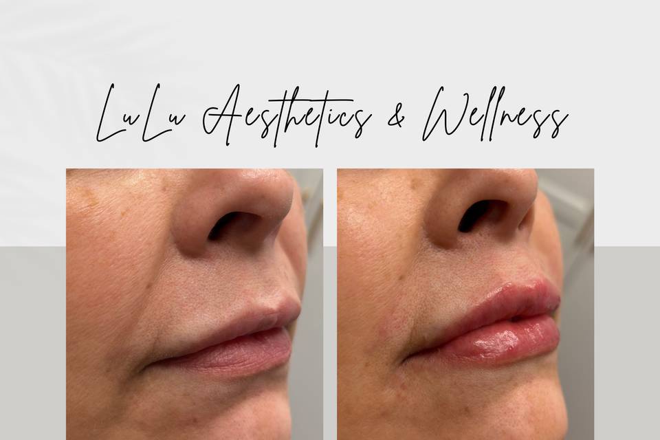 LuLu Aesthetics & Wellness
