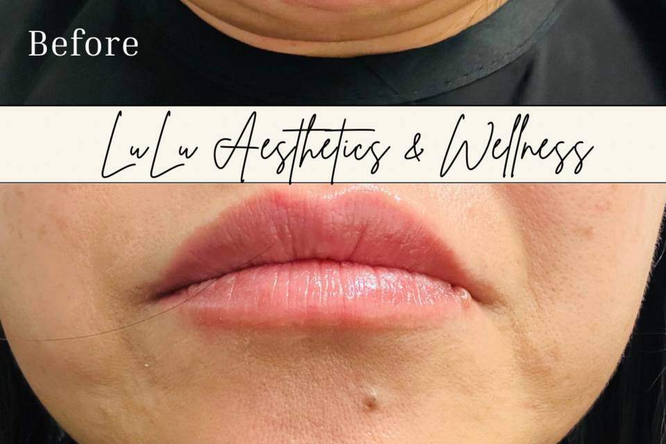 LuLu Aesthetics & Wellness