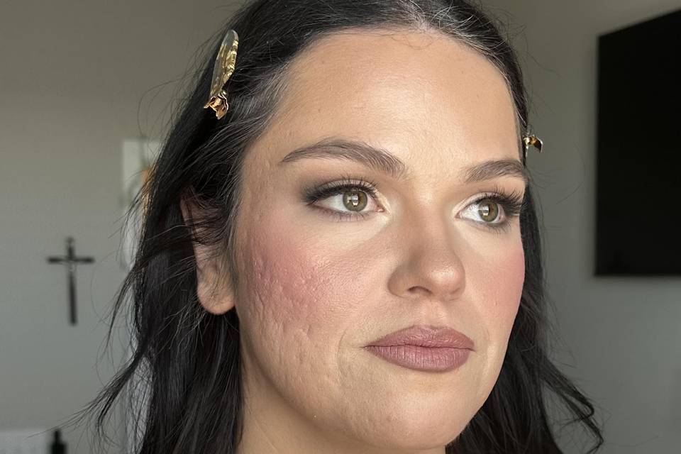 Brunette acne scars.jpg