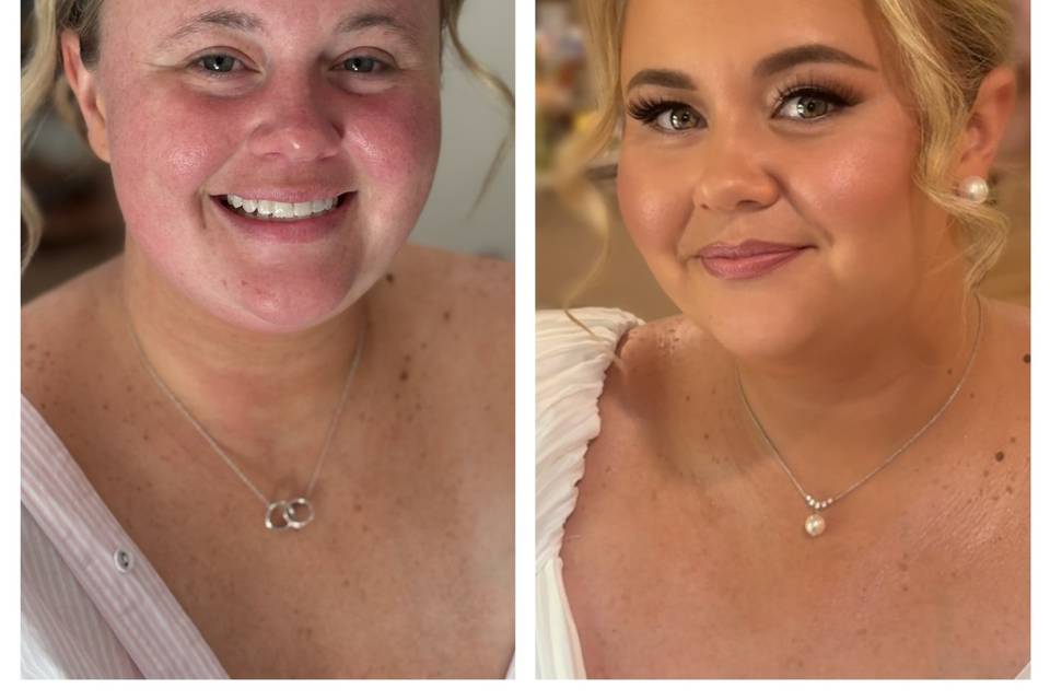 Before and After