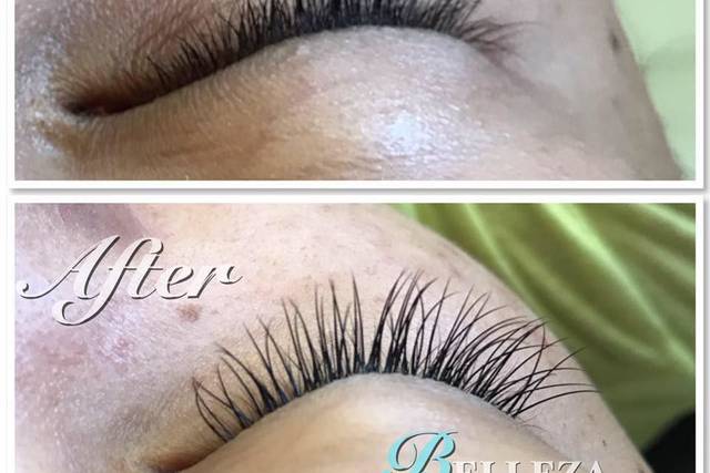 Before and after
