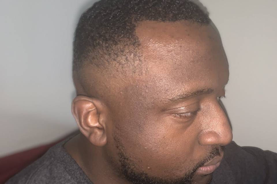 Bald Fade
