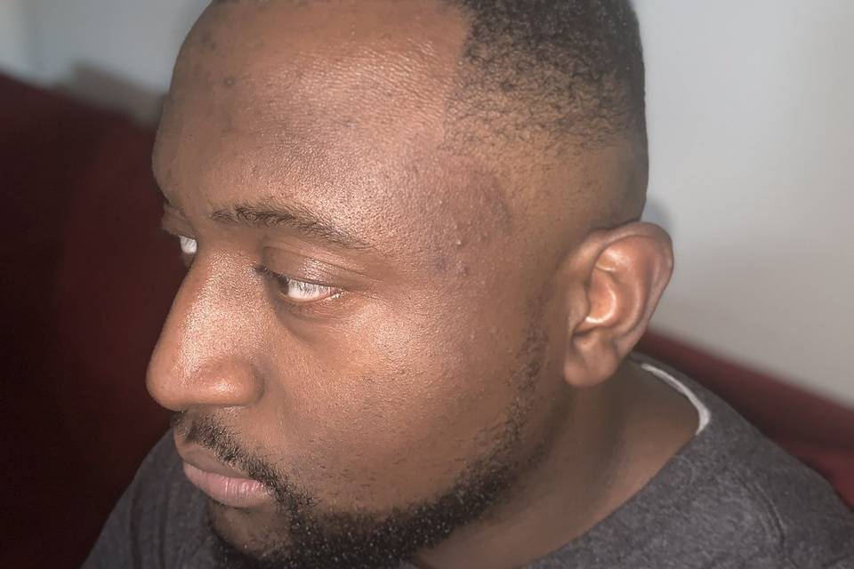 Bald Fade
