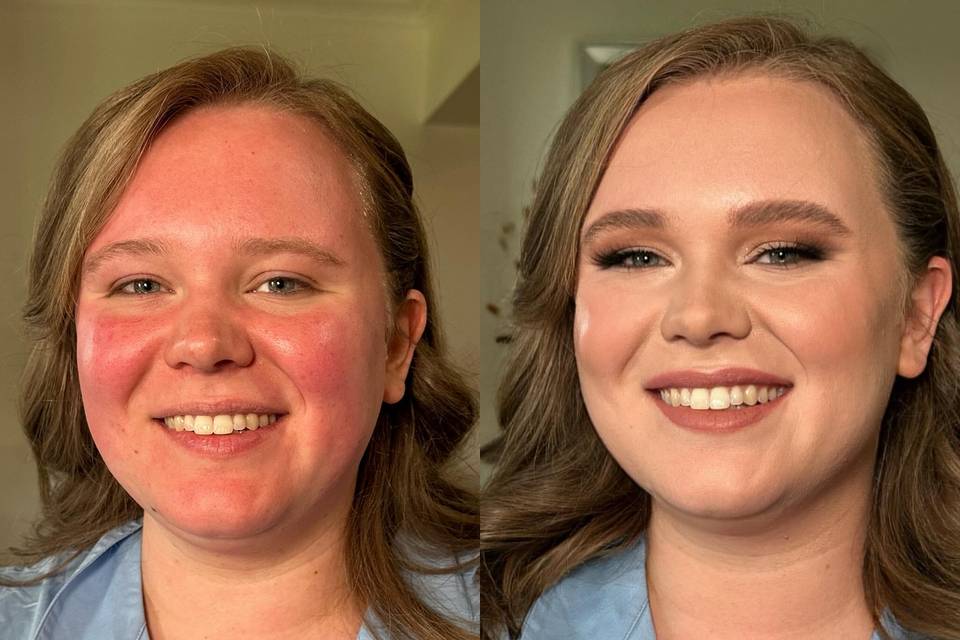 Before and Afters