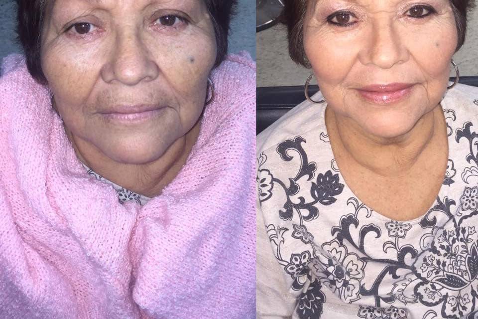 Before and after