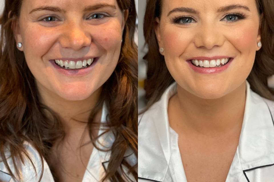 Beauty before & after