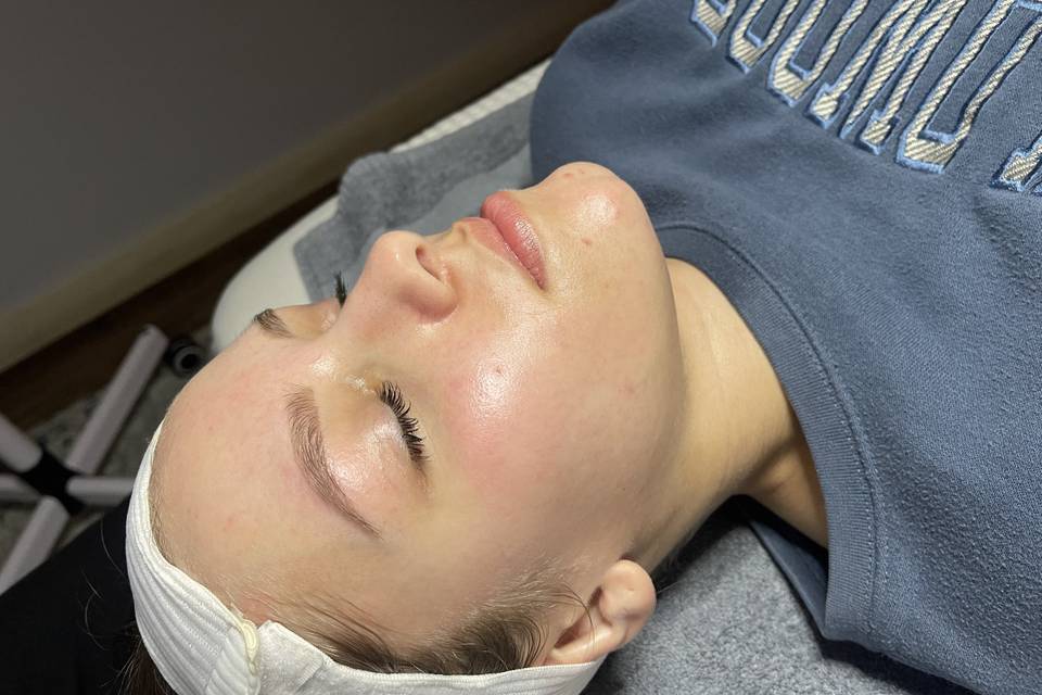 Dermaplane treatment