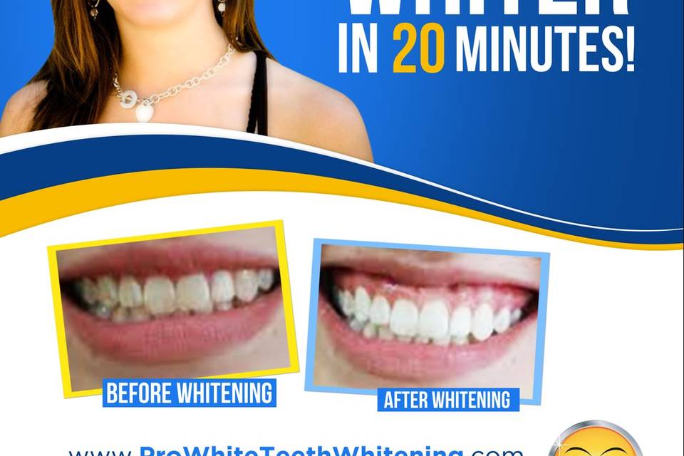 Express Teeth Whitening Inc