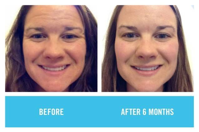 Rodan and Fields Skincare by Mary Ann