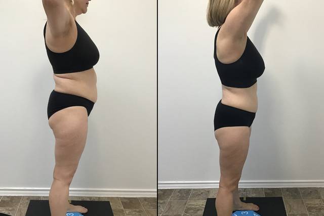 Weight Loss Before & After
