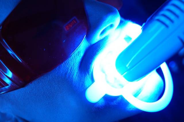 At-Home teeth whitening