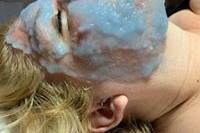 Targeted facial