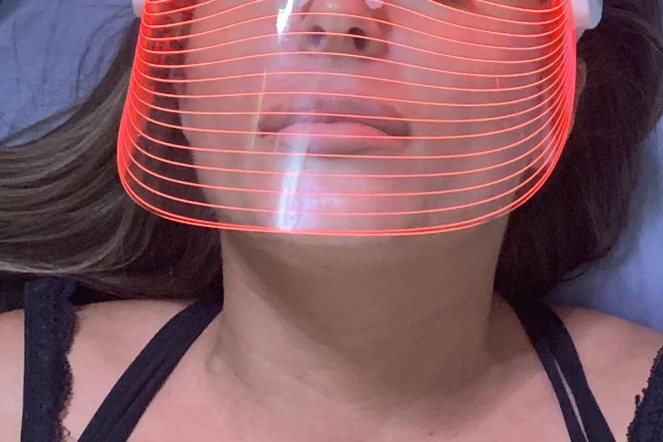 UV Light Therapy