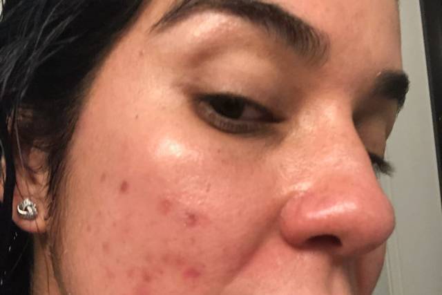 Texture Skin Before Glotique