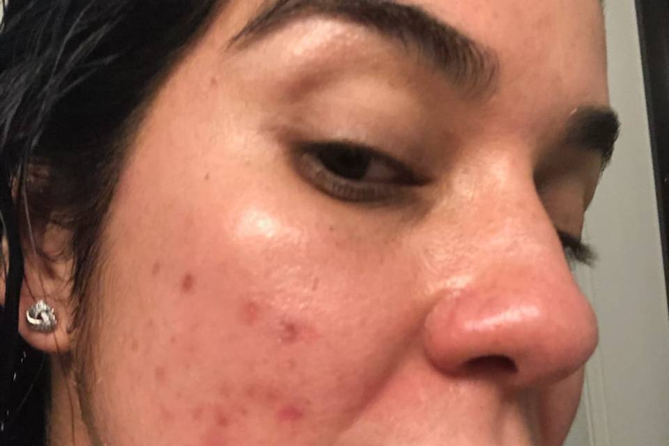 Texture Skin Before Glotique