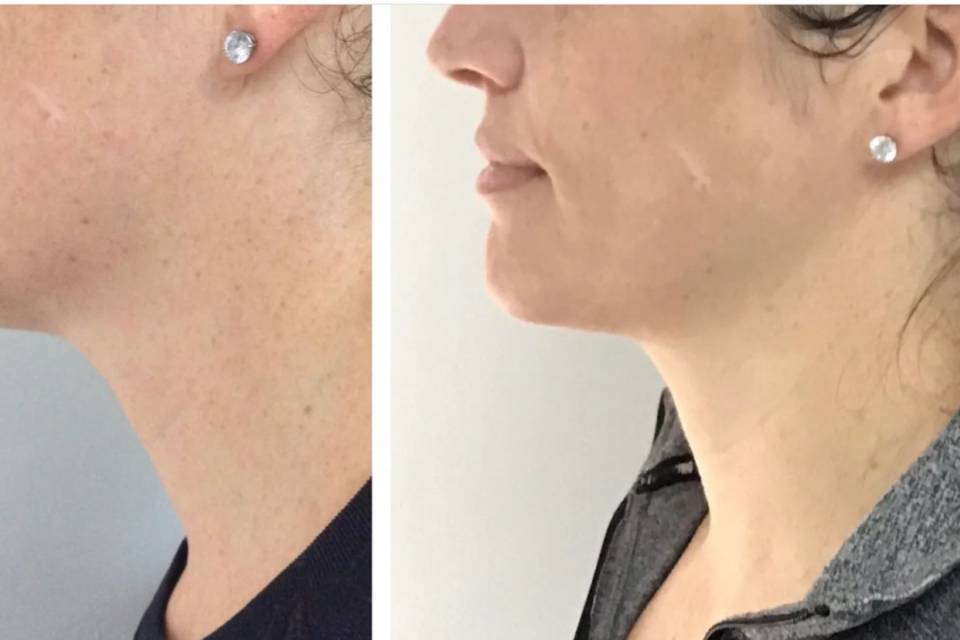 California Body Contouring