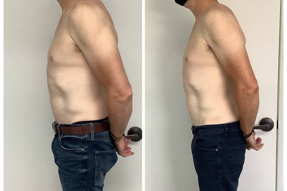 California Body Contouring