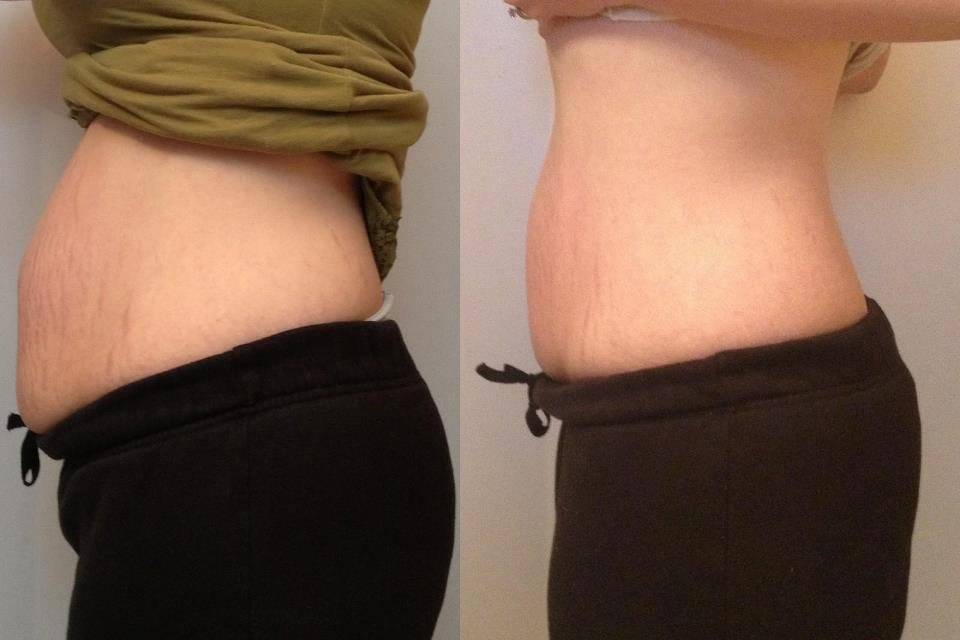 It Works! Body Wraps