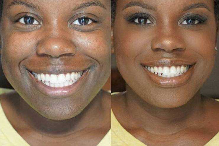 Stunning before and after