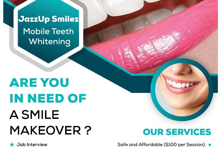 Jazz Up Smilez mobile teeth whitening