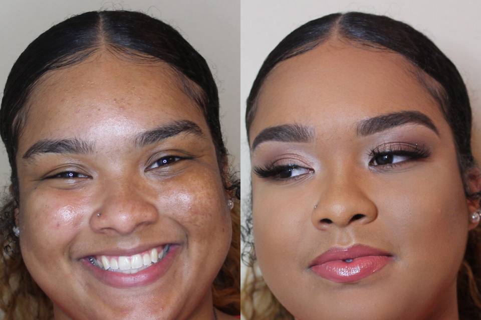 Client Before/After