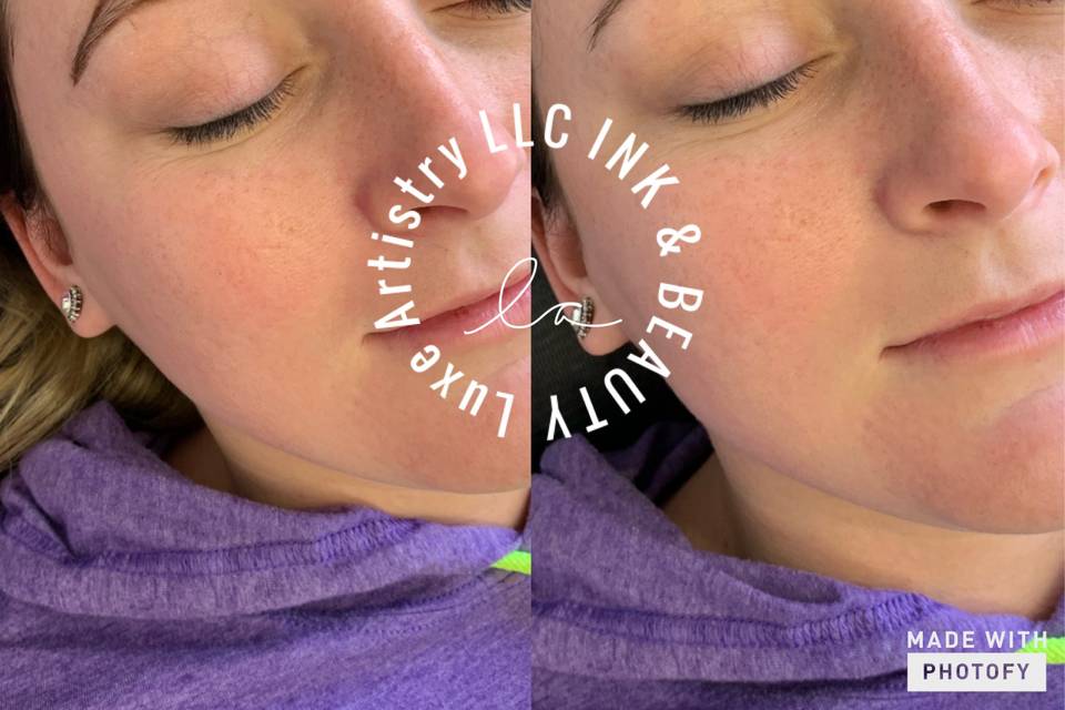 Microblading Before & After