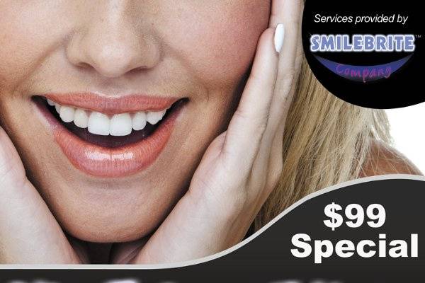 Smile Brite Company