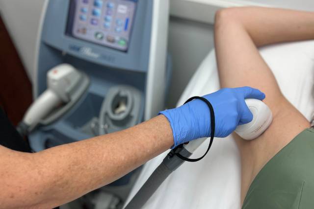 Laser Hair Removal
