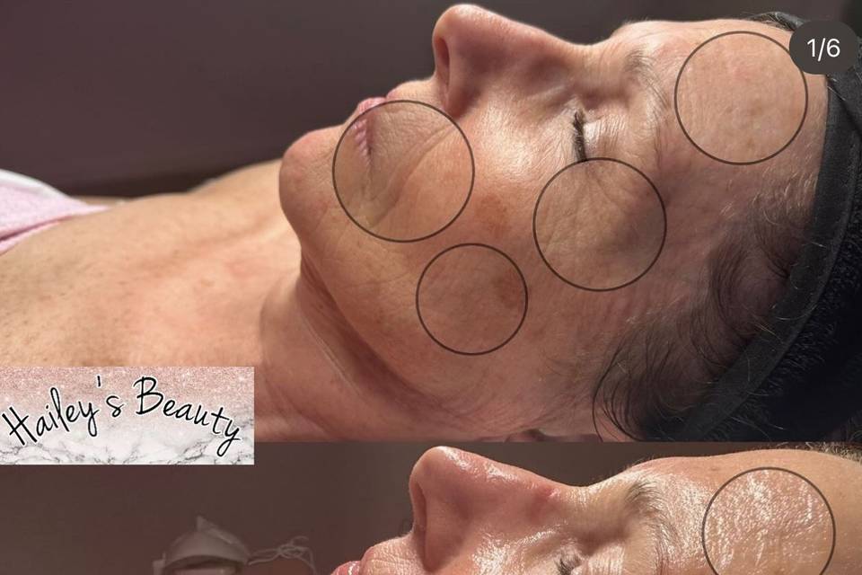 Aging / pigment