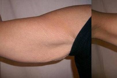 It Works Body Wraps Tampa, FL