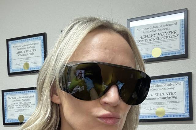Laser IPL time!