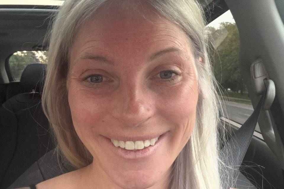 Before facial and Daxxify