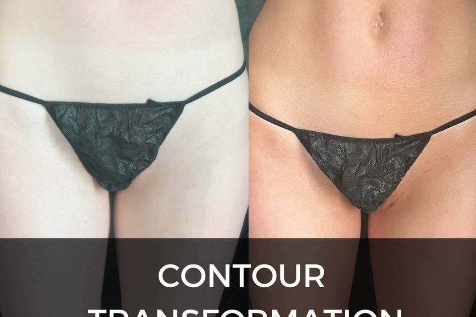 Contour transformation