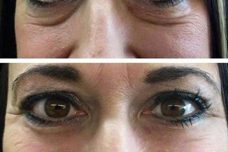 Instantly Ageless by Jeunesse (Ind. Distributor)