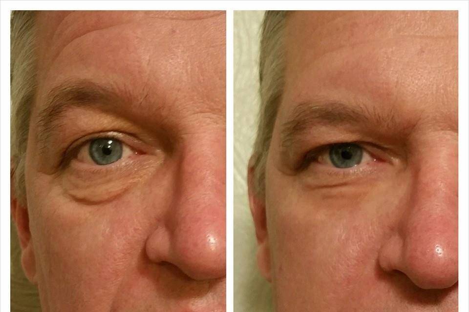Instantly Ageless by Jeunesse (Ind. Distributor)