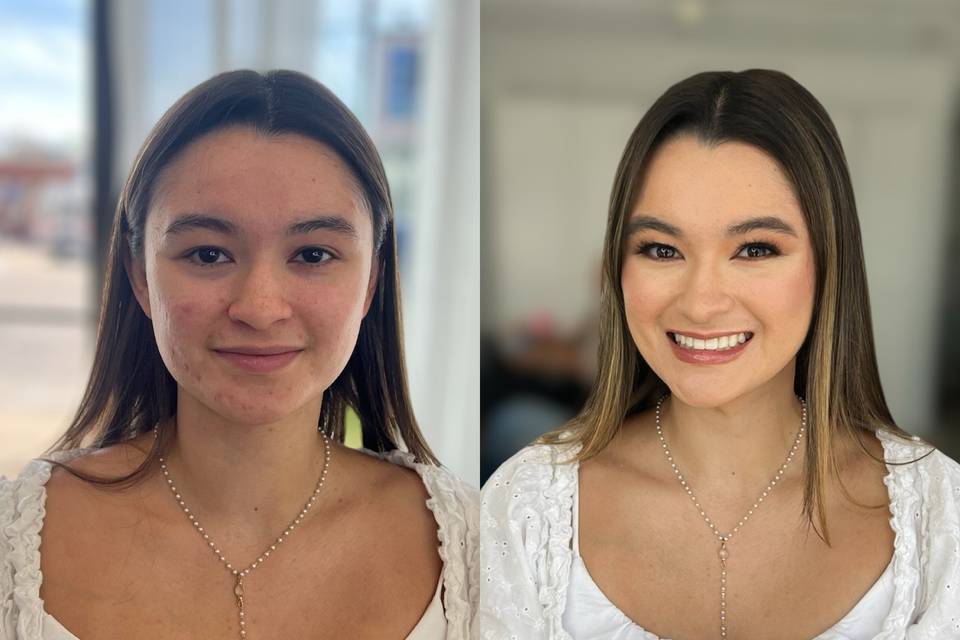Before and After