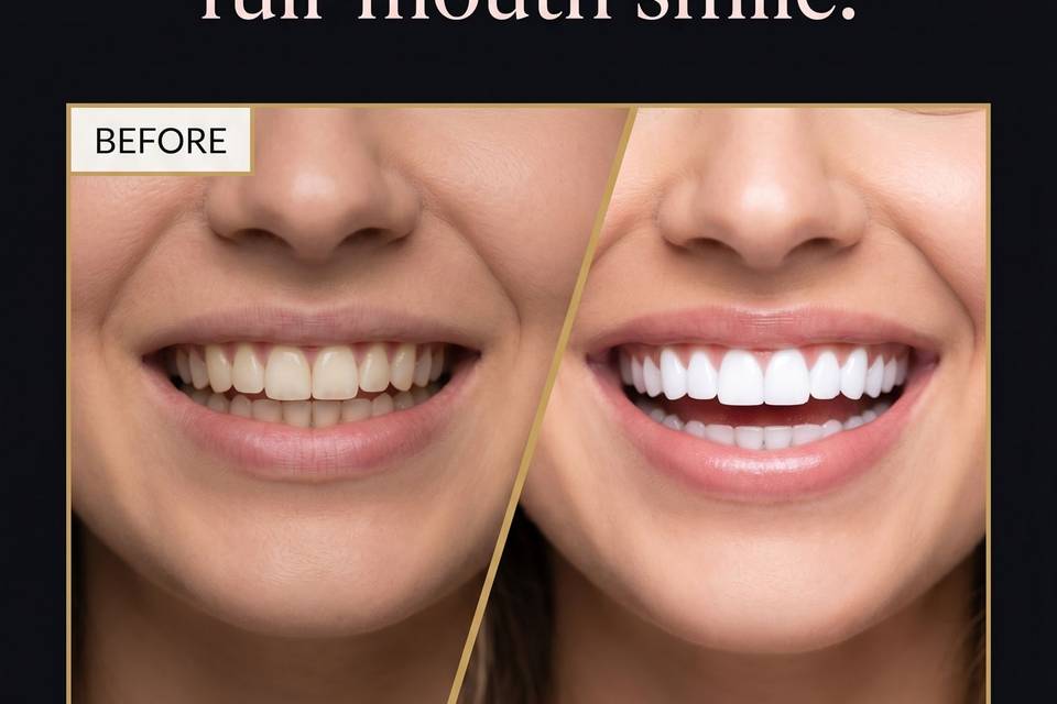 Before/After