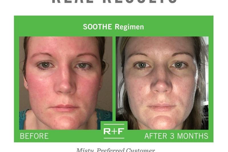 Rodan + Fields Skincare - Elizabeth Banks