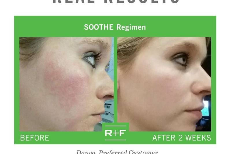 Rodan + Fields Skincare - Elizabeth Banks