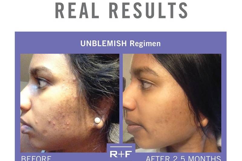 Rodan + Fields Skincare - Elizabeth Banks