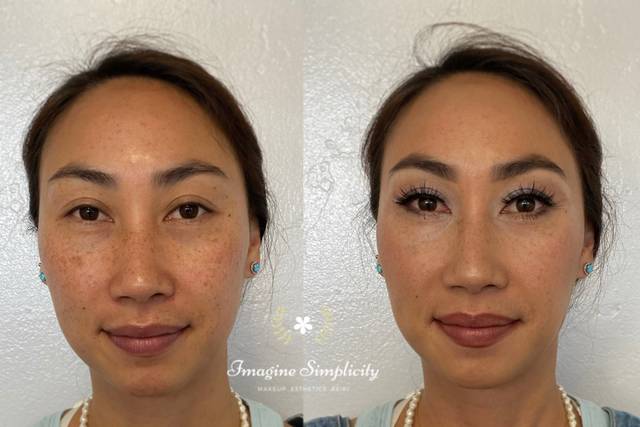 Before and after