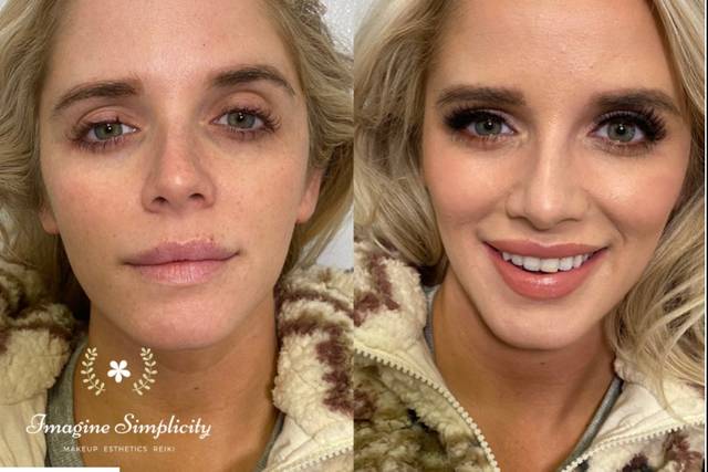 Before and after