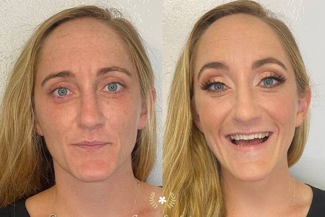 Before and after