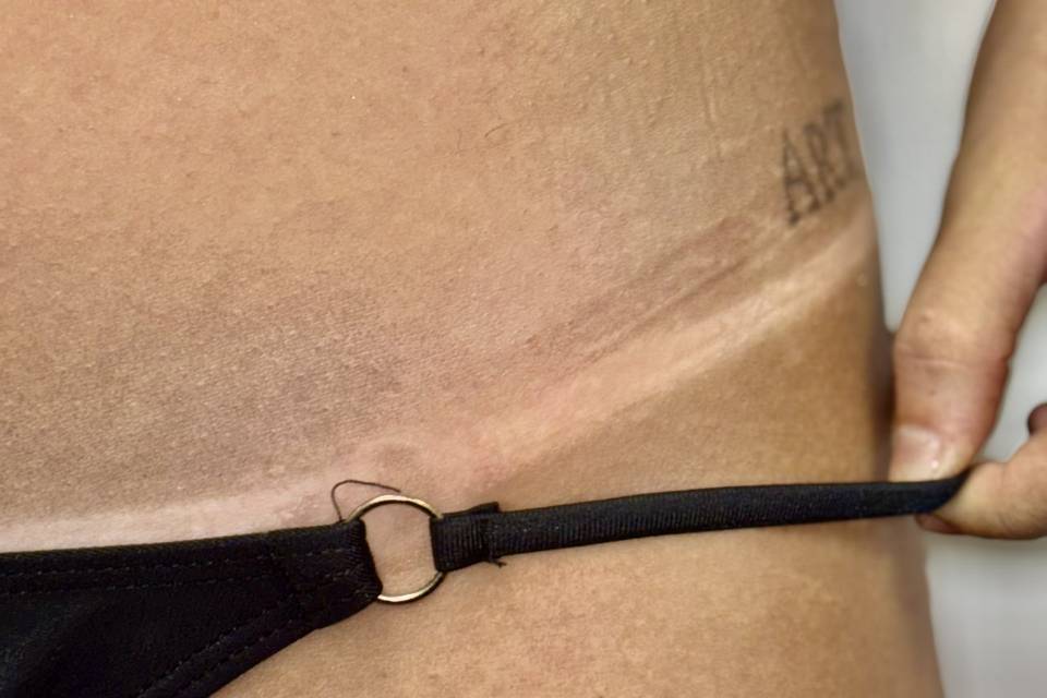 Spray tan
