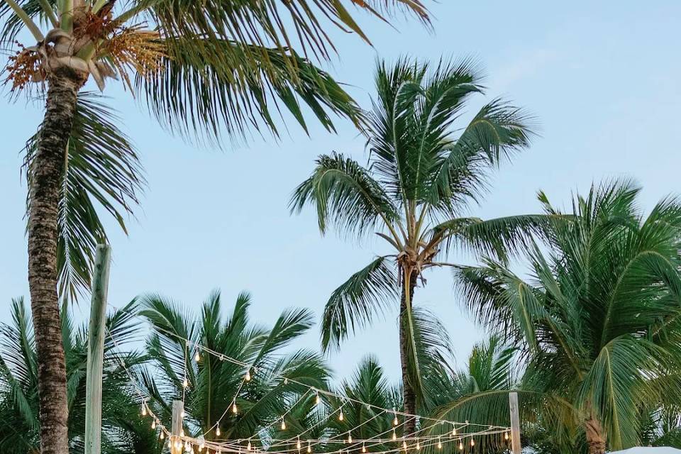 Romantic Outdoor Lighting Setu
