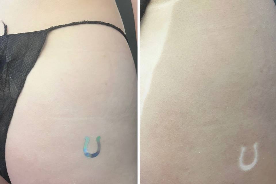 Before and After