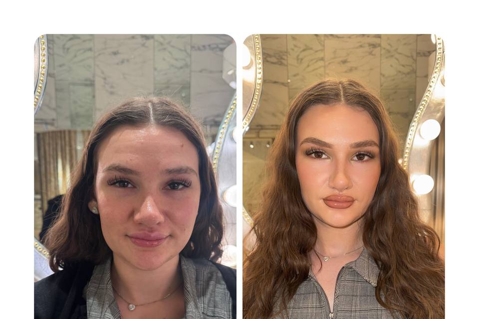 Before and After